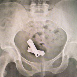 The Scars of War by María Ximena Borrazás Cataldo