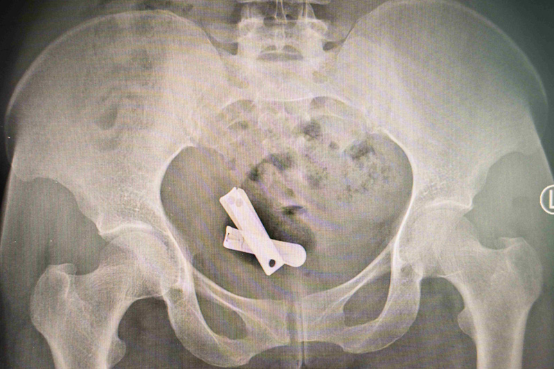 The Scars of War by María Ximena Borrazás Cataldo